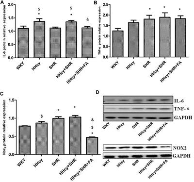 Folate Reverses NF-κB p65/Rela/IL-6 Level Induced by Hyperhomocysteinemia in Spontaneously Hypertensive Rats